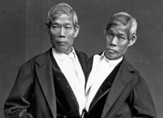10 cei mai fascinanti gemeni siamezi din istorie
