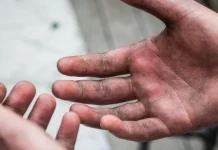 10 lucruri șocante găsite în corpul uman