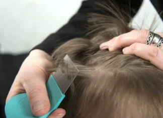 Cum sa scapi de paduchi: 6 solutii eficiente