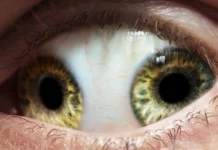 Top 10 al celor mai ciudate afecțiuni medicale