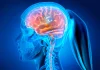 Ce sunt implanturile cerebrale si care sunt beneficiile potentiale?